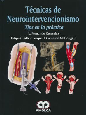 Libro Tecnicas de neurointervencionismo: tips en la practica (2016)