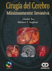 Portada de Cirugia del cerebro minimamente invasiva + dvd