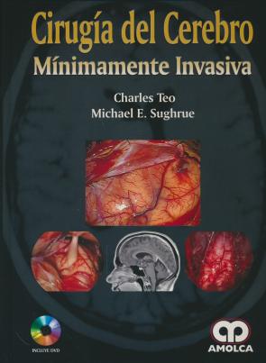 Libro Cirugia del cerebro minimamente invasiva + dvd (2016)