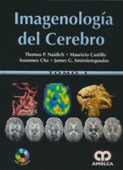 Portada de Imagenologia del cerebro