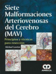 Libro Siete malformaciones arteriovenosas del cerebro (mav) (2016)