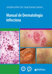 Libro Manual de dermatologia infecciosa (2016)